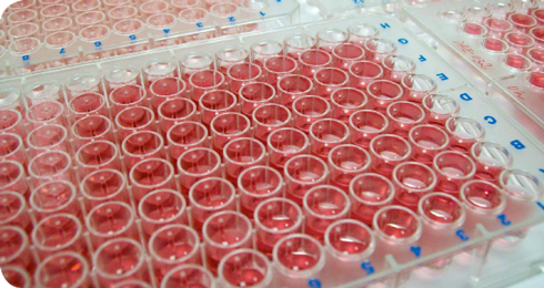 Laboratory enzyme trials
